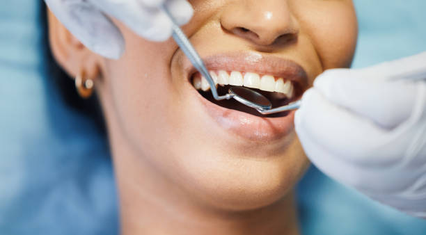 Best Tooth Infection Emergency Dentist  in Pilot Point, TX